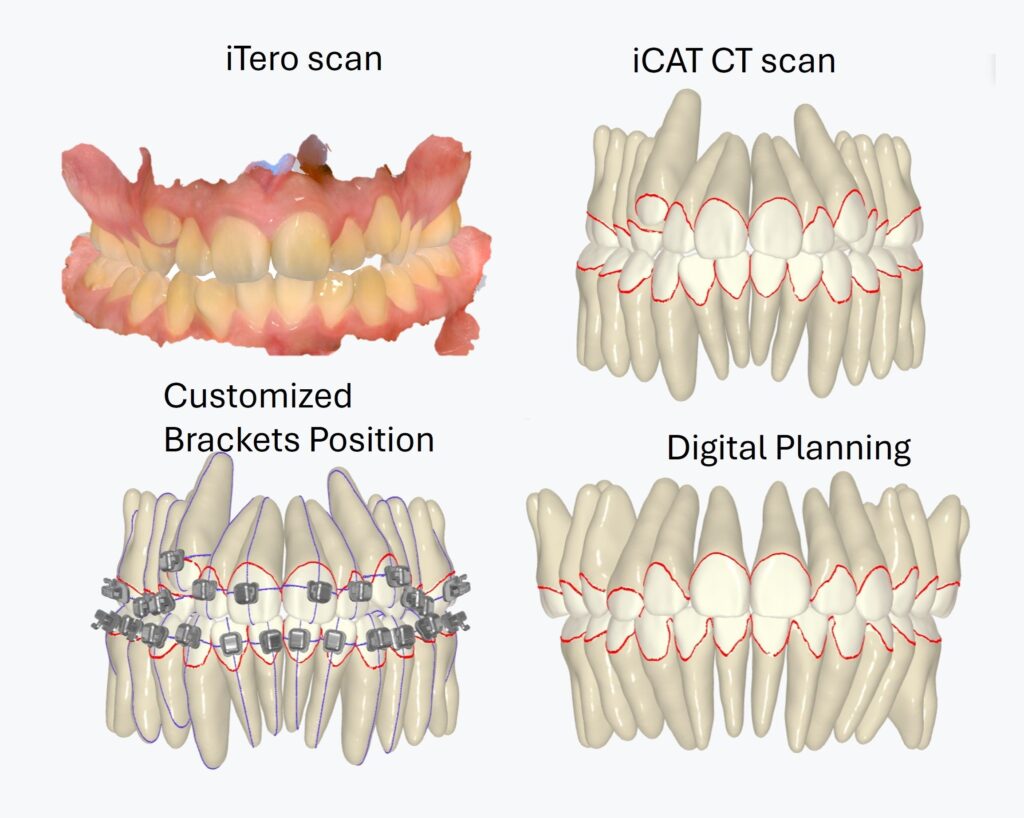 Advance technology 1