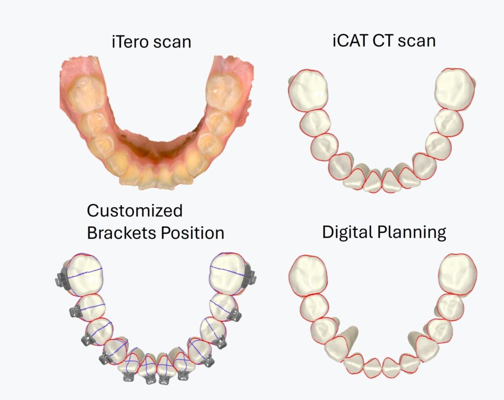 Advance technology 4