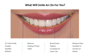 Smile Arc - PhD Orthodontics